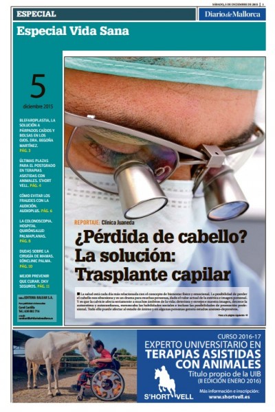 Doctor José María Mir en Diario de Mallorca. Injerto capilar