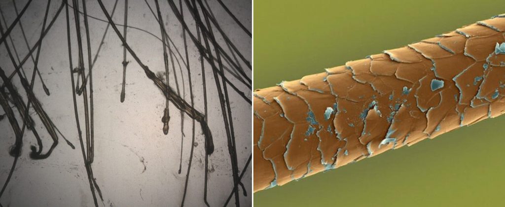 El tricograma es el estudio de los pelos mediante microscopia óptica (izquierda). También podemos estudiar el pelo mediante microscopia electrónica (derecha).